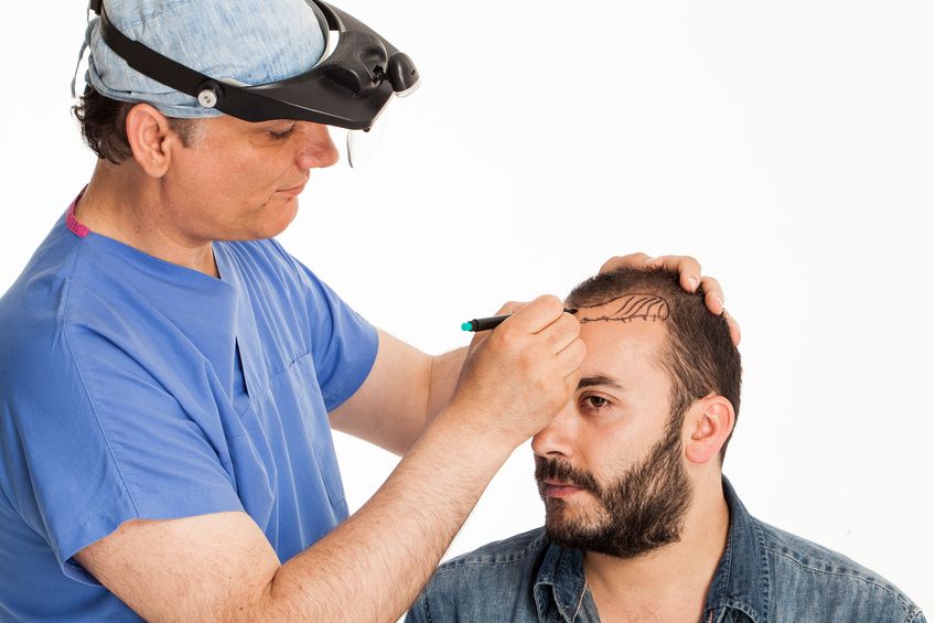 Hair transplant surgery: FUE hair implantation Budapest, Hungary