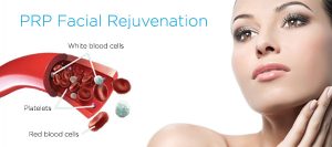 PRP facial rejuvenation